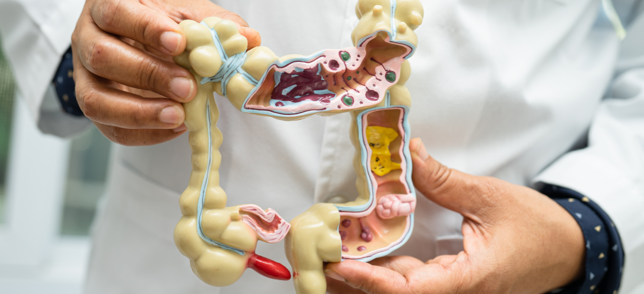 The Gut-Heart Connection: How Digestive Health Influences Atrial Fibrillation