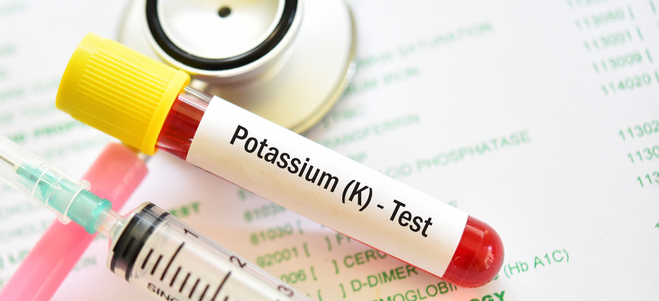 When Potassium Drops: Hypokalemia and Its Role in Atrial Fibrillation